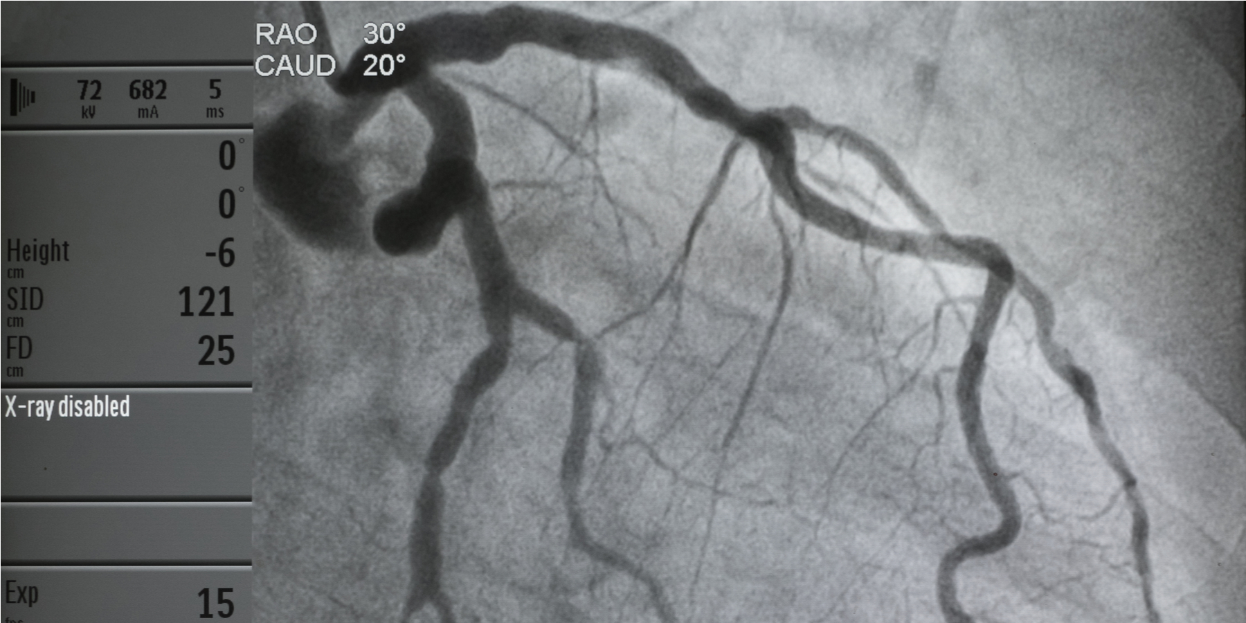Cardiac Catheterization and Defensive Medicine Journal of Ethics