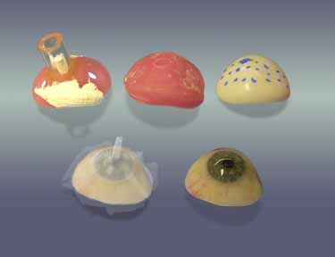 he process of fabricating an artificial eye in acrylic, as seen in stages.